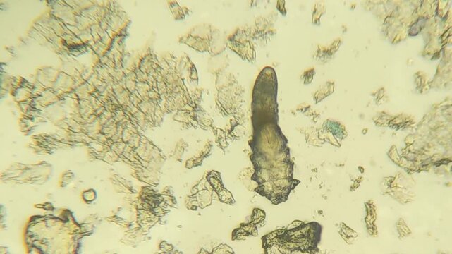 Demodex mite parasite visible under microscope magnification