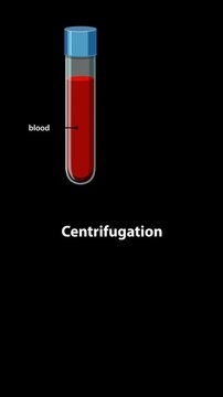 Medical Animation of Blood Centrifugation Process and Component Separation