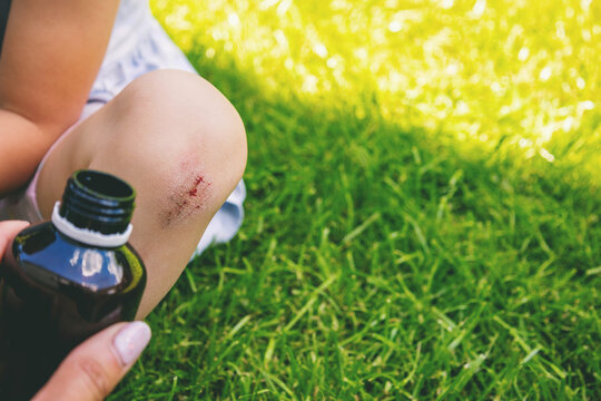 Treating child scraped knee wound with antiseptic bottle and cotton pad outdoors.