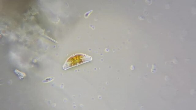 Cymbella diatom microalgae