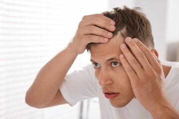 Fototapeta premium Young man examining his head at home