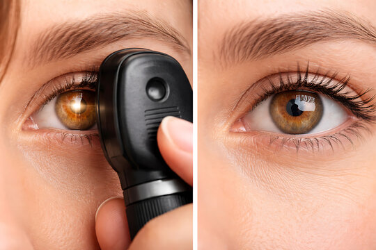 Closeup eye examination with ophthalmoscope showing detailed vision screening and medical diagnosis