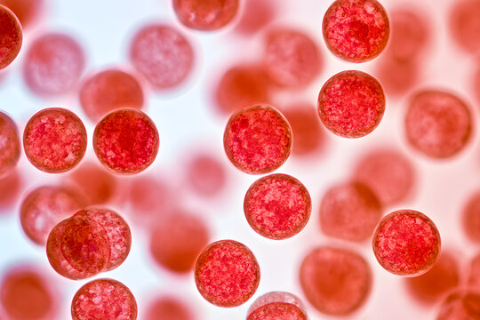 Cyclosporiasis is a condition caused by infection with the parasite Cyclospora cayetanensis, often spread through contaminated water or food