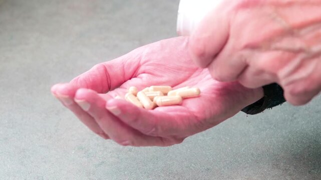 Hand holds pills, palm open, ready to receive. Pink skin shows signs of aging or medical condition. Handedness implies care, medical treatment, or personal health