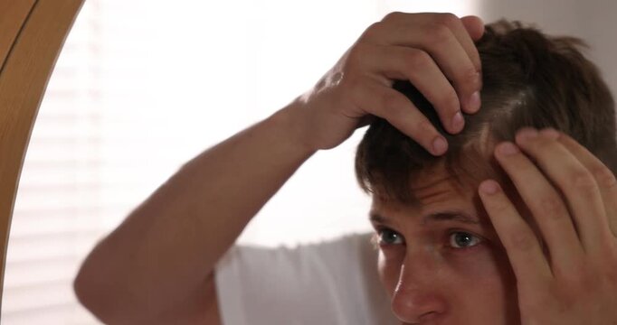 Dandruff problem. Worried man examining his head near mirror at home. Camera moving forward and backwards