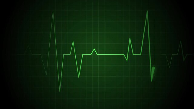 Heartbeat line on a grid pulse pattern for health medicine and emergency monitoring animation