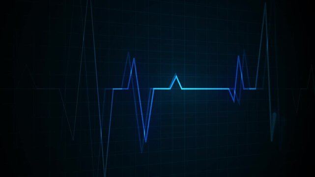 Heartbeat line on a grid pulse pattern for health medicine and emergency monitoring animation