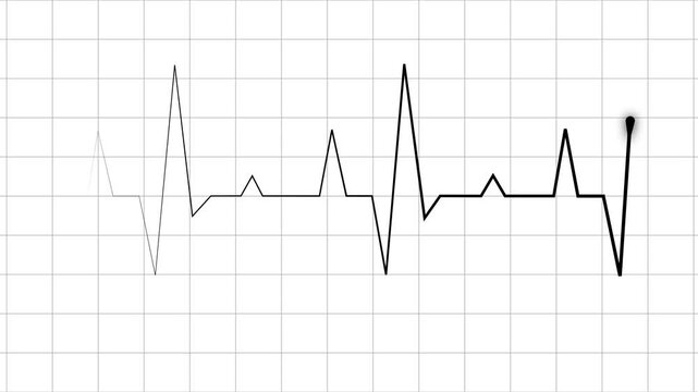 Electrocardiogram line heartbeat trace with sharp peaks and minimal design animation