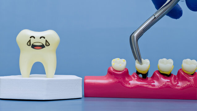 Dentist hand in blue glove extracting a decayed tooth with forceps. Dental surgery and fear concept with a sad crying cartoon tooth.
