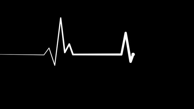 Cardiology Monitor Animation Featuring Heart Rate Wave Signal
