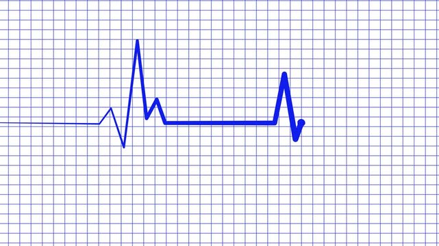 Cardiology Monitor Animation Featuring Heart Rate Wave Signal