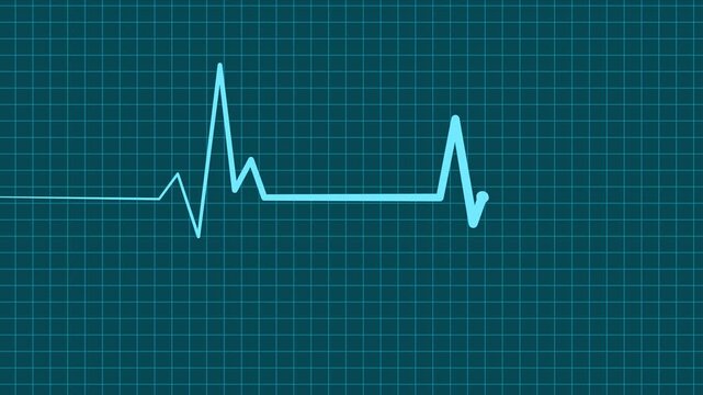 Cardiology Monitor Animation Featuring Heart Rate Wave Signal