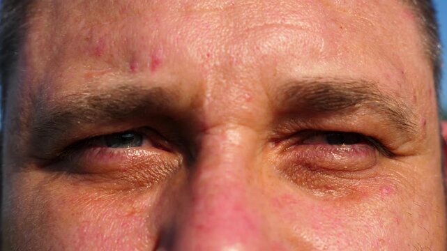 Serious blue eyes of man blinking and looking into camera outdoor. Portrait of male watching with unhappy sight. Upset facial expression of adult human. Close up