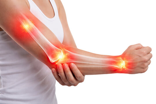 Female arm elbow wrist joint pain inflammation skeletal bone injury arthritis anatomy isolated on white background