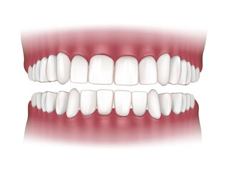 Detailed vector 3D medical illustration of normal human dentition showing healthy upper and lower teeth with regular dental alignment and natural gingival anatomy from a frontal view.  © sakurra
