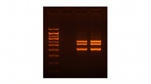 Comparative DNA Fragment Bands Displayed Across Three Different Gel Systems
