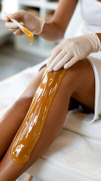 A cosmetologist in protective gloves applies a thick layer of warm golden sugar paste onto a woman smooth leg during a sugaring epilation procedure in a professional wellness spa salon
