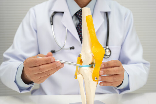 Osteoarthritis of the knee, Doctor holding human knee joint orthopedic anatomy model in hospital.
