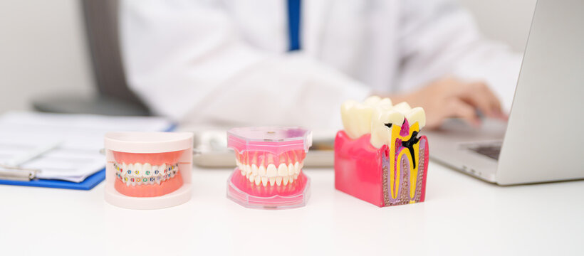 Tooth Anatomy and Orthodontic model on dentist table. Oral Teeth and disease. March Oral health, Dentist Day, False Teeth. Toothache and Children Dental Health Month and May Orthodontic Health Day
