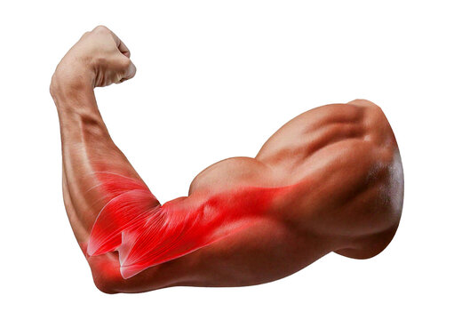 Inflamed Biceps Brachii (Turns slightly red). isolated on transparent or white background
