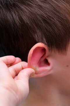 Red swollen ear of a child caused by irritation or infection. Close up of an inflamed auricle skin condition being examined by hand. Medical concept for pediatrician or dermatology.