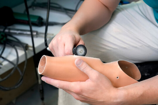Bright workshop, a person uses a rotary tool on a prosthetic leg to improve its fit. They are modifying the device so the disabled person can gain mobility
