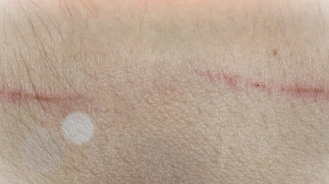 Seamless 4K looping vertical movement across natural human skin texture with a subtle healed scar. Ideal for medical educational anatomy and dermatology related visuals.