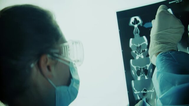 Doctor Examining Brain CT Scan X-Ray Image On Light Box. Medical Research 