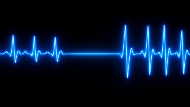 Blue glowing heartbeat line stopping into a flatline and then restarting on a black background, concept of cardiac arrest and resuscitation, life and death