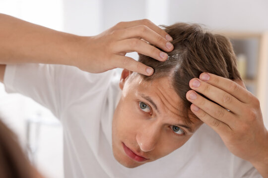 Dandruff problem. Young man examining his head at home
