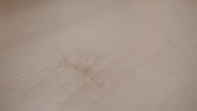 Extreme close view of small light skin patch with radial fine hairs emerging from central follicle, showing subtle bending from gentle contact, soft shadows, natural texture, and clinical detail