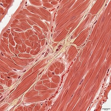 Photorealistic illustration of the human rectum and sigmoid colon, showing the dense nerve supply responsible for autonomic function. anatomical grade clipart.