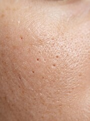 Fototapeta premium Extreme macro view of human facial skin showing natural potrait texture and open pores for dermatology articles, skincare marketing, and medical educational materials