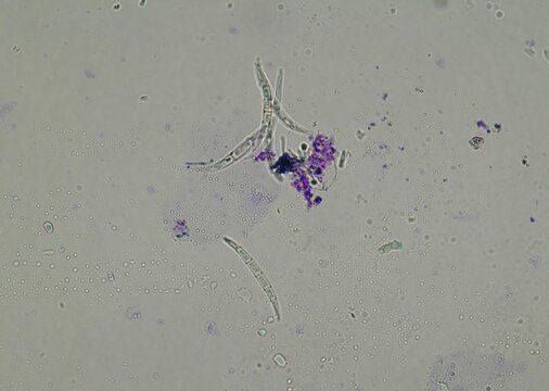 soil microorganisms under a microscope including amoeba, flagellates, nematodes, fungi, bacteria	