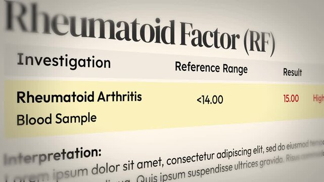Rheumatoid arthritis blood test results with high rheumatoid factor, reference range, medical diagnosis report, health analysis, 4k animation.