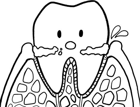 Gingivitis