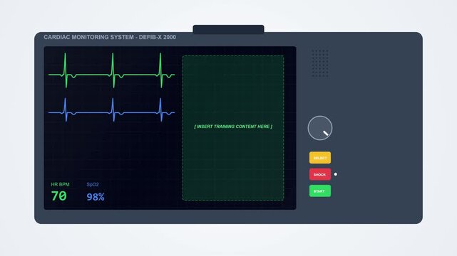 Flat Vector Animation of Medical Heart Rate Monitor Screen.
