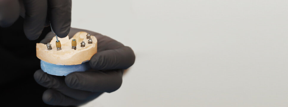 Doctor tightening a dental implant component with a surgical instrument on a jaw model, securing the implant during dental implant placement and prosthetic restoration procedure. banner copy space