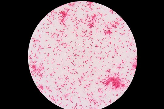 Microscopic salmonella bacteria under a microscope lens