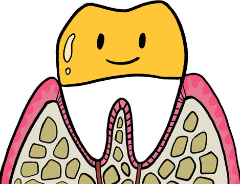 Root canal treatment5