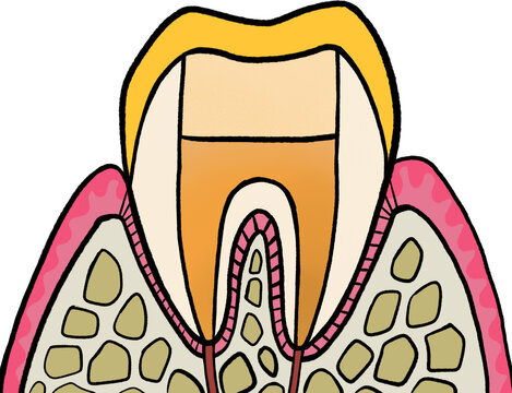Root canal treatment5