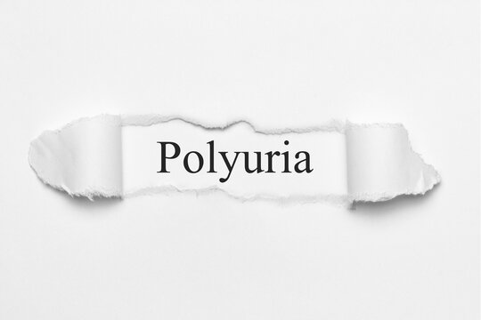 Polyuria	
