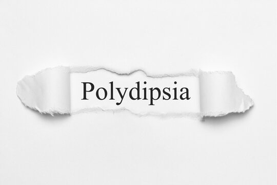 Polydipsia	

