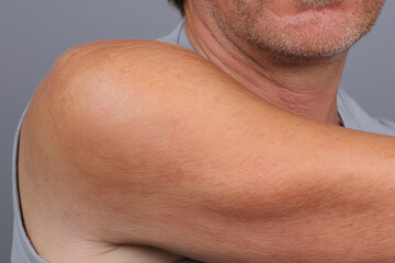 Fototapeta premium Close up of male elbow skin with mild roughness and darker tone, visible pores and stubble near jawline showing natural texture and aging