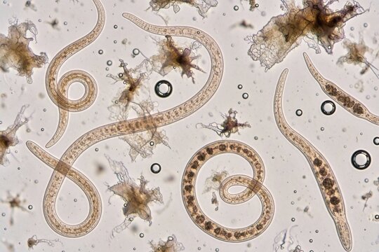 Microscopic view of nematode worms and debris in lab sample. Parasites are visible under magnification with cellular structures and some liquid bubbles.