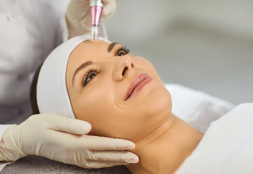 Cosmetologist, dermatologist beautician using dermapen tool miconeedling roller pen performing female face care facial deep cleansing, skincare instrument for professional treatments, woman enjoying