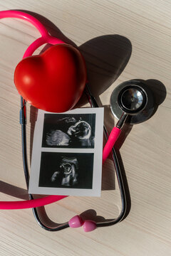 Photo: Ultrasound screening of a child and stethoscope. Image of an embryo.