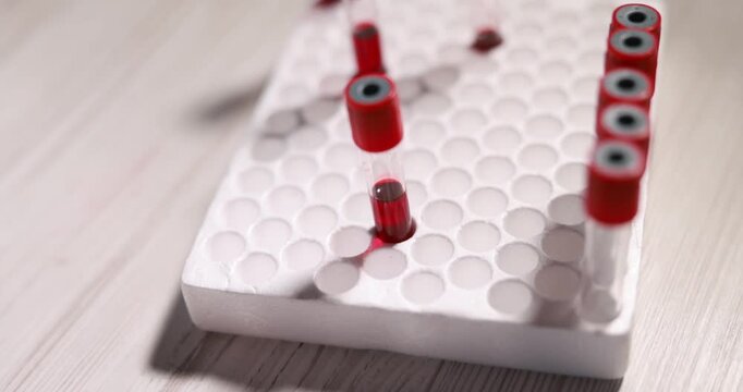 Blood analysis. Woman with medical bandage on her hand and laboratory worker putting test tube into rack, selective focus. Camera moving forward