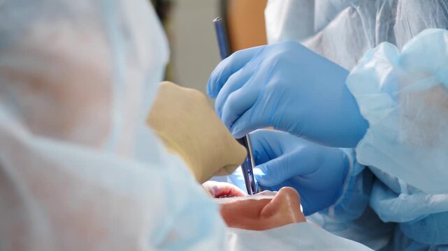 Dental surgeon performing surgical manipulation inside patient oral cavity using precise instrument. Professional stomatology treatment, preparation for gum reconstruction or implant surgery 4k video