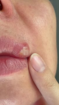 close up of a male face with finger
